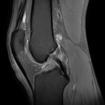 MRI kruisband Dokter Dujardin Jan orthopedie heup en knie specialist traumatologie operatie nieuwe knie heup prothese meniscus kruisband sportgeneeskunde izegem hechting kraakbeen operatie chirurg heelkunde arthrose arthritis pijn petré defoort vandendriessche knieprothese heupprothese topdokter arts kunstknie topdokters beste kunstheup topchirurg